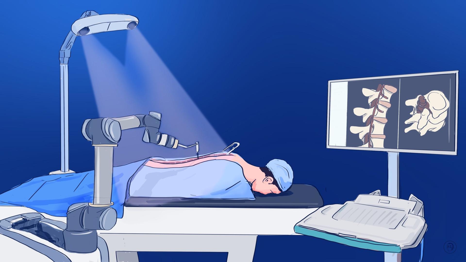 An illustration by Alex Santafe depicting a medical robot performing an operation